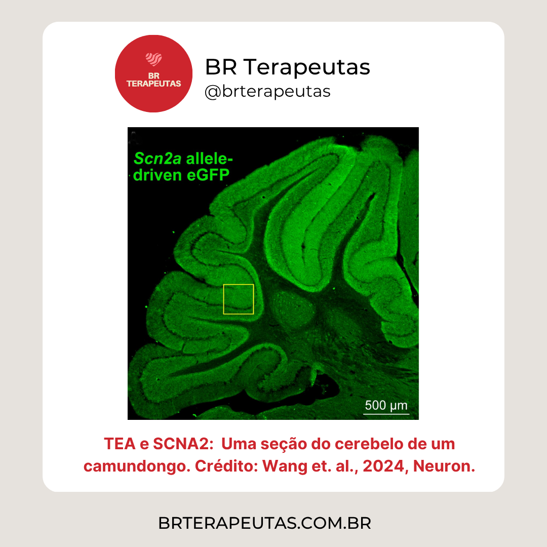 TEA e SCNA2 Uma seção do cerebelo de um camundongo. Crédito: Wang et. al., 2024, Neuron.